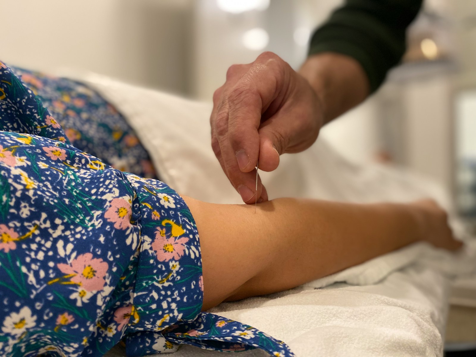 Acupuncture session in progress with a practitioner placing needles carefully.